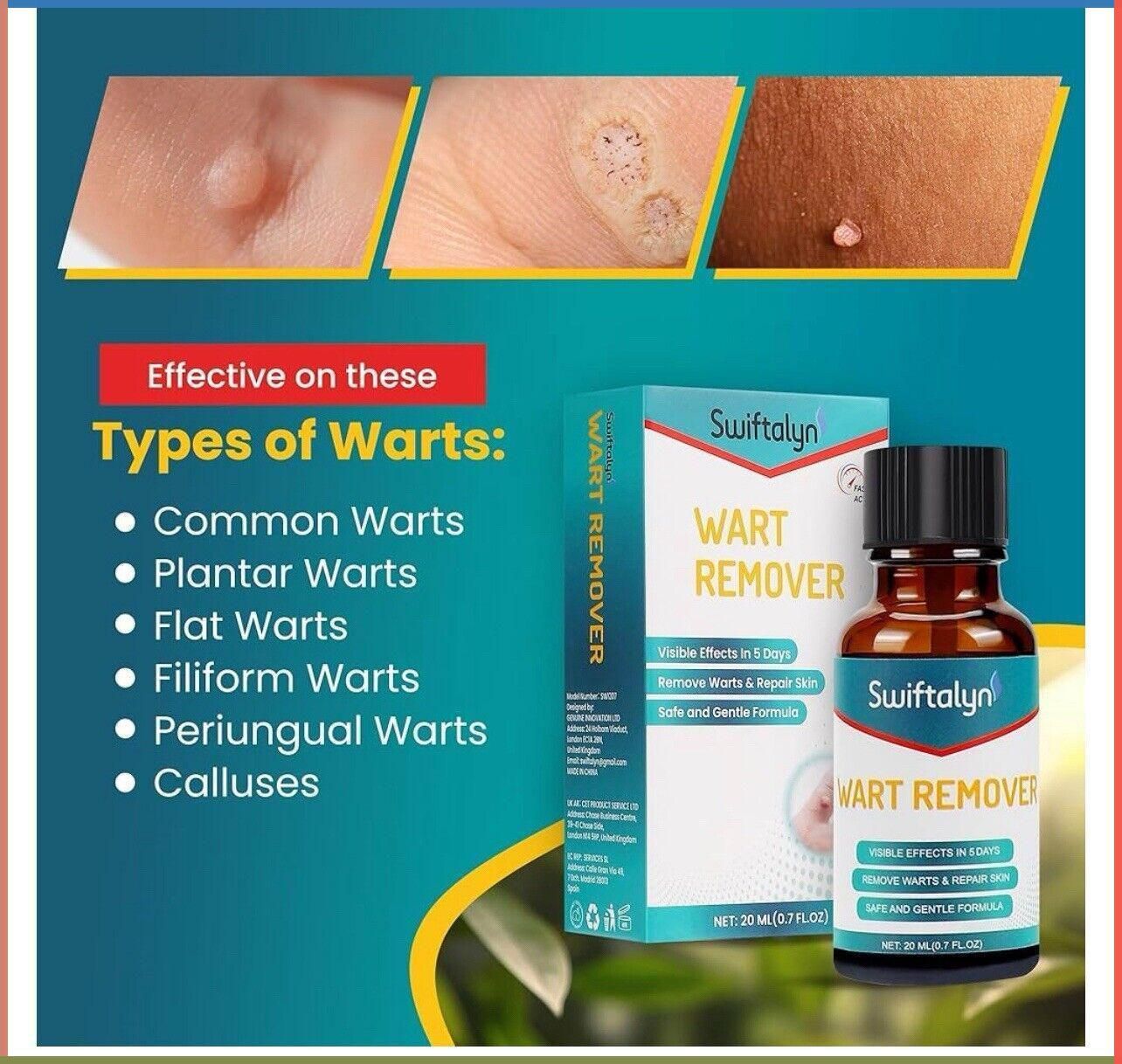 Wart Remover 20ml Visible effects in 5 days – SEALED NEW exp 2027  | eBay