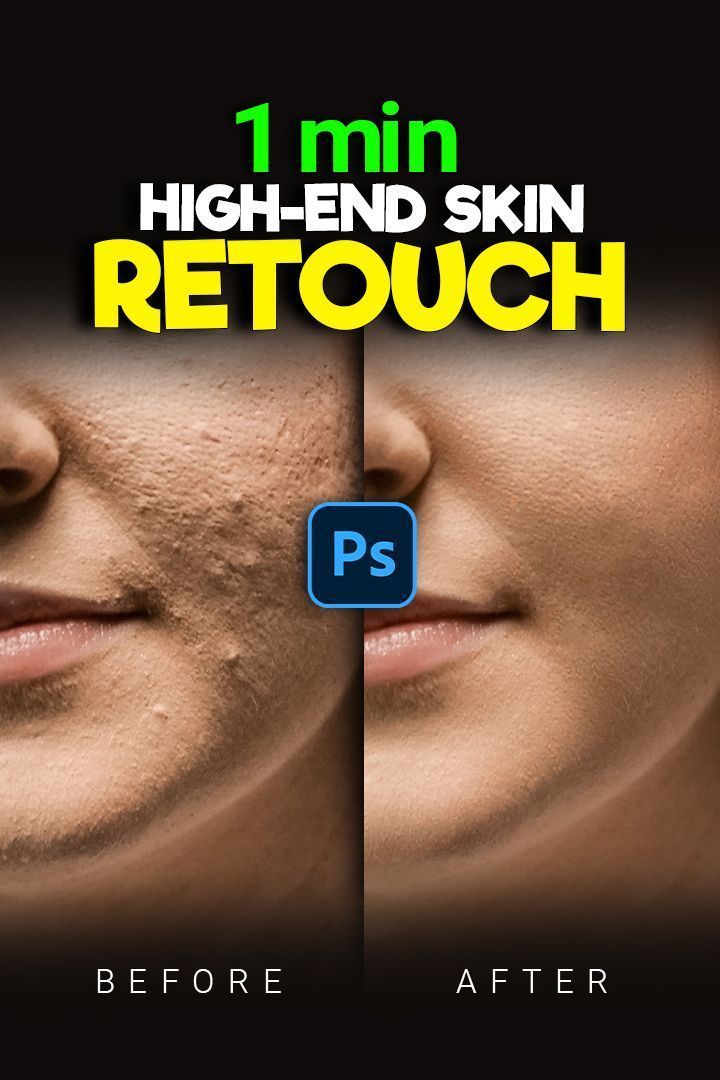 A Quick and Easy Way to Repair Skin in Photoshop
