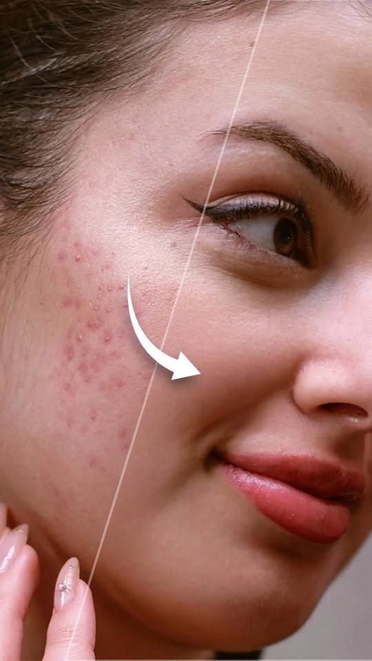 667K views · 7.4K reactions | How to Soften Skin in Photoshop Photoshop #short Tutorials#photoshop #graphicdesign #designtips #art #viralshorts #photoshopshorts #illustrator #design #pigma #canva #smartgraphic #posterdesign #photomanipulation #texteffect #mockupdesign #mockup #flyerdesign #productmanipulation #businesscarddesign #quciktips #pctips #pcshortcuts #photoshortfree | Smart Graphics | Facebook