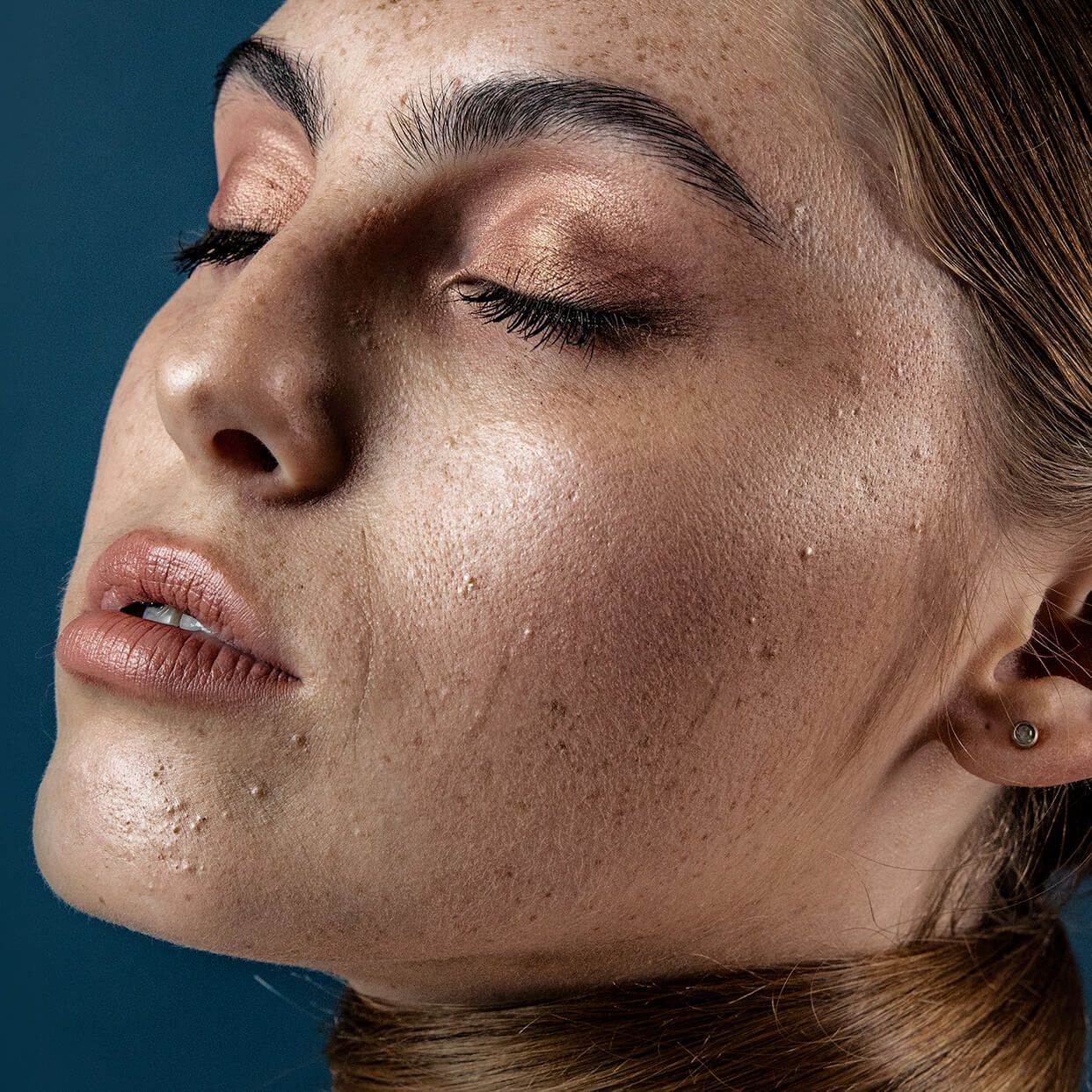 A Woman With Freckles On Her Face Is Looking Away From The Camera While She’s